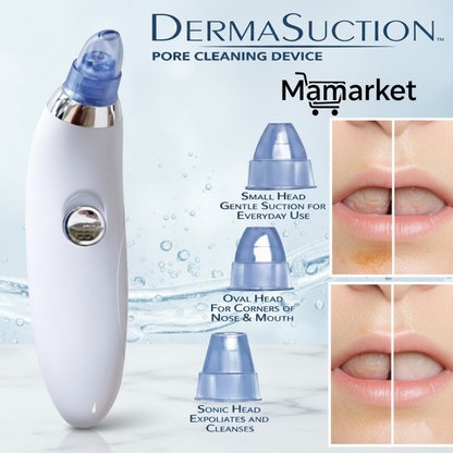 Advanced Blackhead Remover Pore Vacuum Cleaner