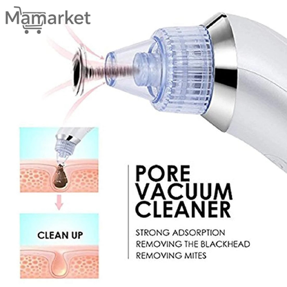 Advanced Blackhead Remover Pore Vacuum Cleaner