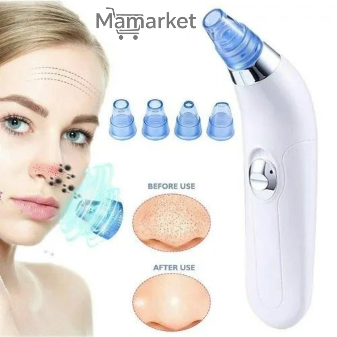 Advanced Blackhead Remover Pore Vacuum Cleaner