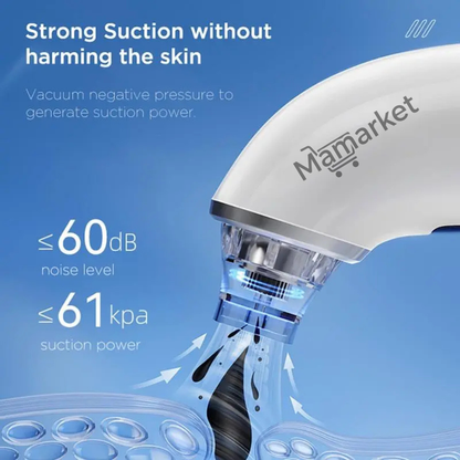 Advanced Blackhead Remover Pore Vacuum Cleaner